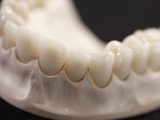 Modelo de dentadura superior