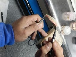 Manos trabajando en dentadura