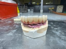 Modelo de dientes en laboratorio