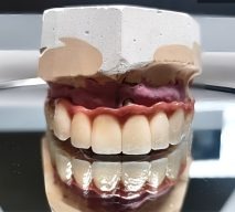 Modelo dental en exhibición